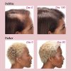 Viviscal Women's Hair Growth Supplements for Thicker, Fuller Hair - Image 4