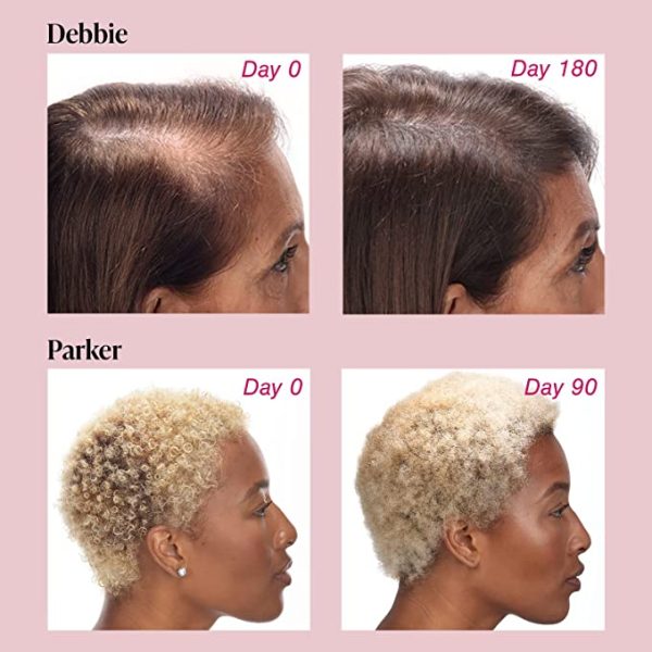 Viviscal Women's Hair Growth Supplements for Thicker, Fuller Hair - Image 4
